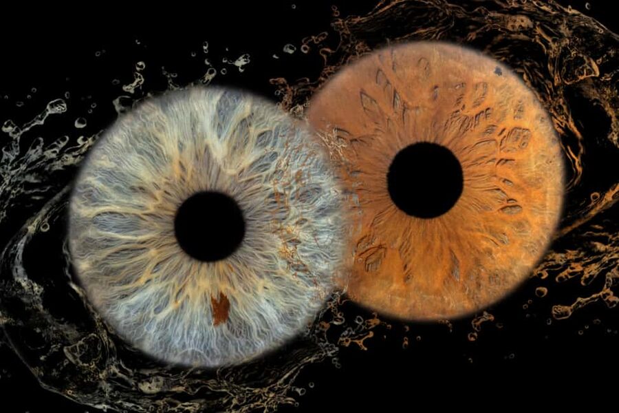 IRIS Photography (macro photo of your eye) - Key points to know before booking